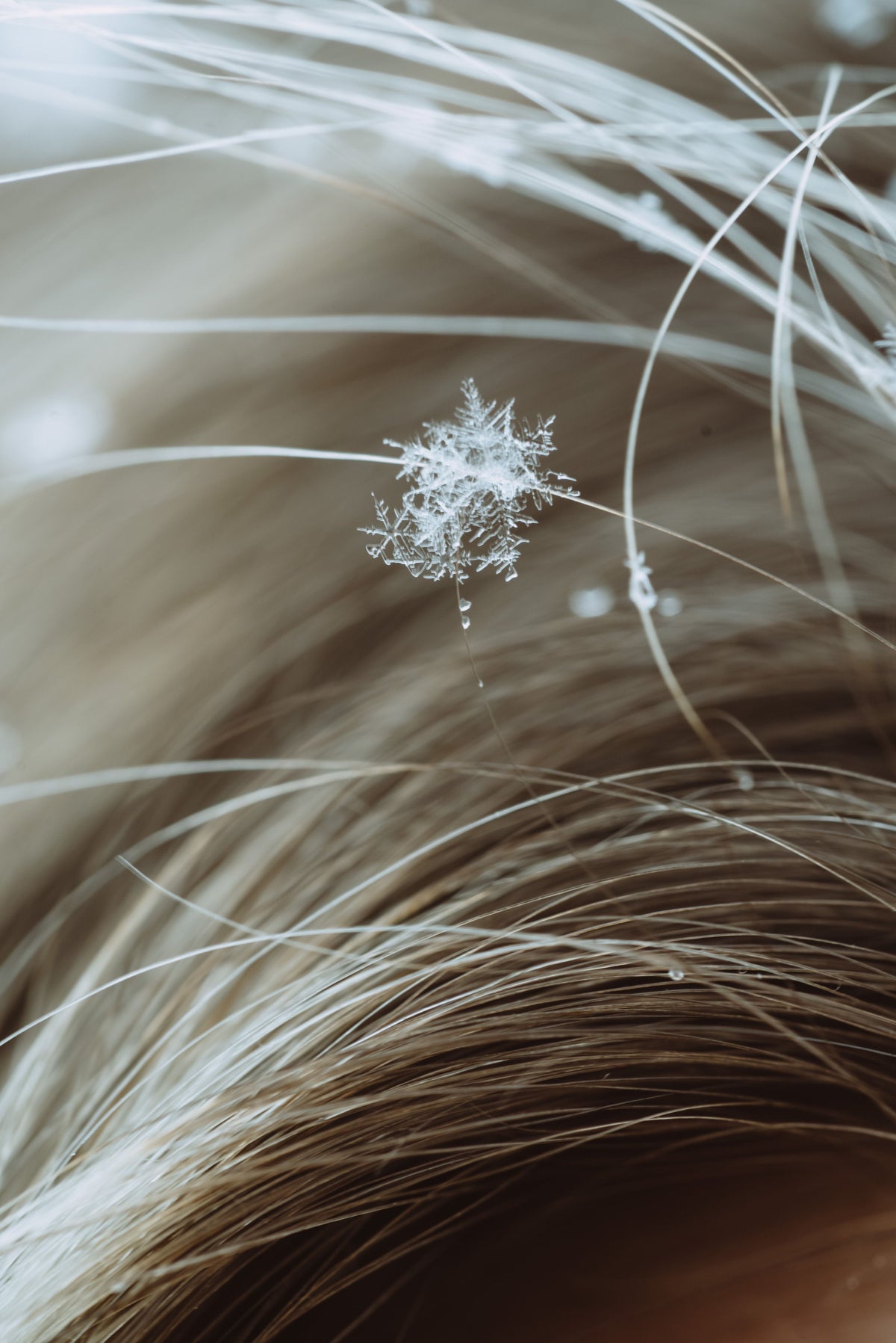 Why Your Dandruff Keeps Coming Back (And How to Actually Stop It)